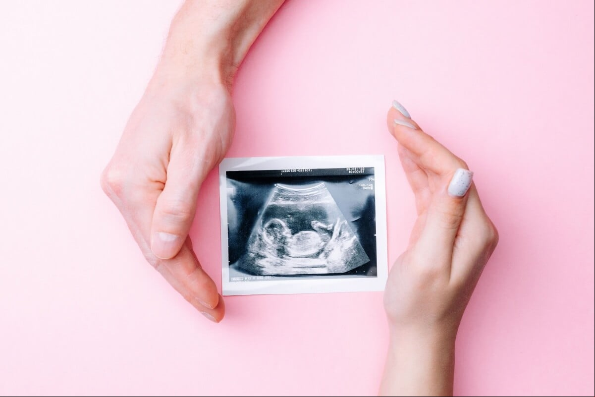 O aborto de repetição acontece quando a mulher sofre três perdas seguidas