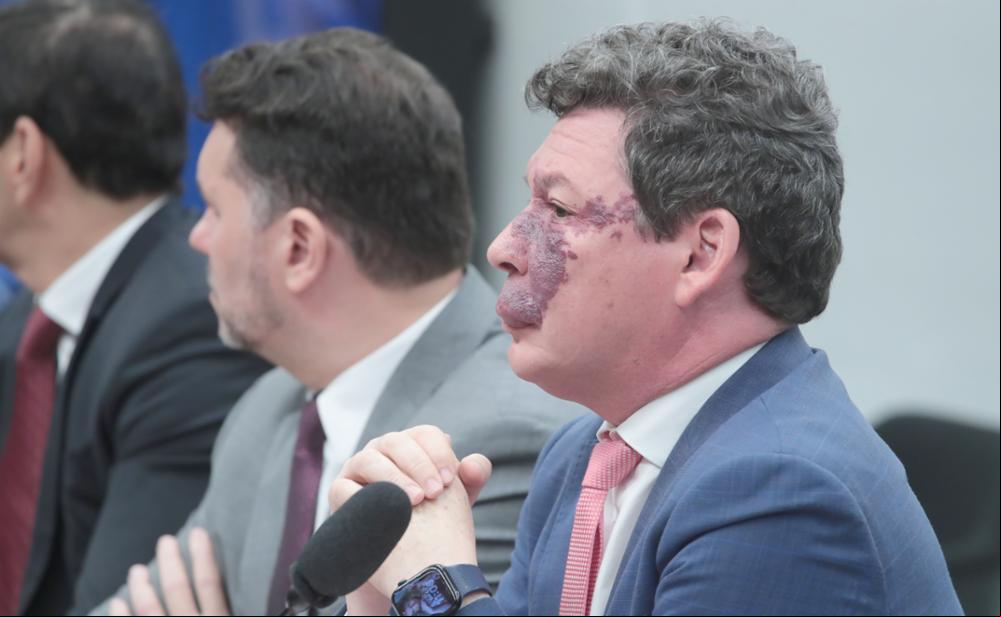 Deputado federal Reginaldo Lopes (PT-MG) O deputado federal Reginaldo Lopes (PT-MG) acredita que o Colégio de Líderes ou o plenário da Câmara ainda possam chegar a um acordo e incluir as armas e munições no Imposto da Maldade